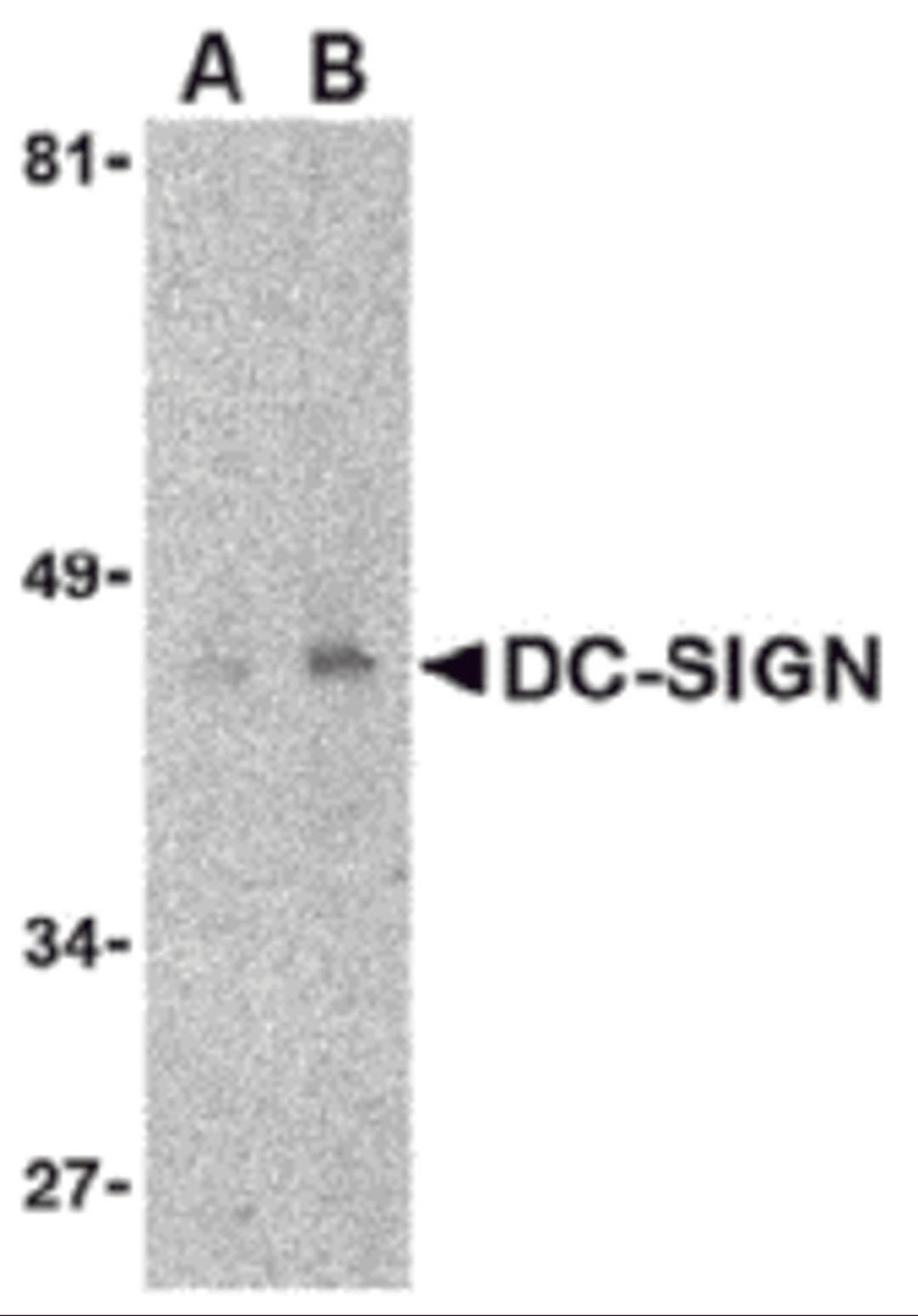 Western blot detection of DC-SIGN in human uterus tissue lysate at (A) 1 and (B) 2 μg/mL.
