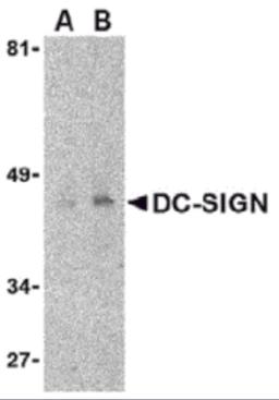 Western blot detection of DC-SIGN in human uterus tissue lysate at (A) 1 and (B) 2 μg/mL.