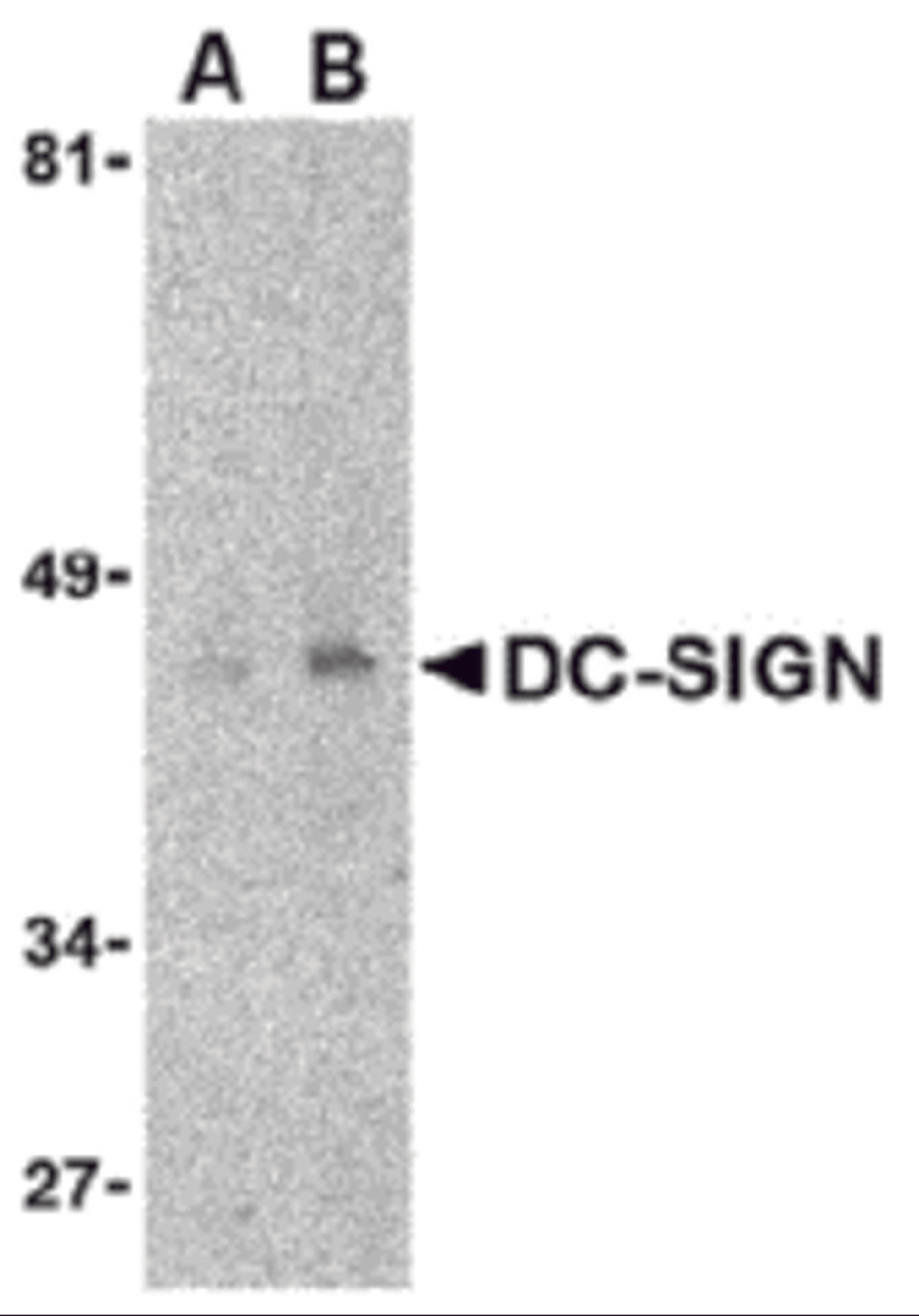 Western blot detection of DC-SIGN in human uterus tissue lysate at (A) 1 and (B) 2 μg/mL.