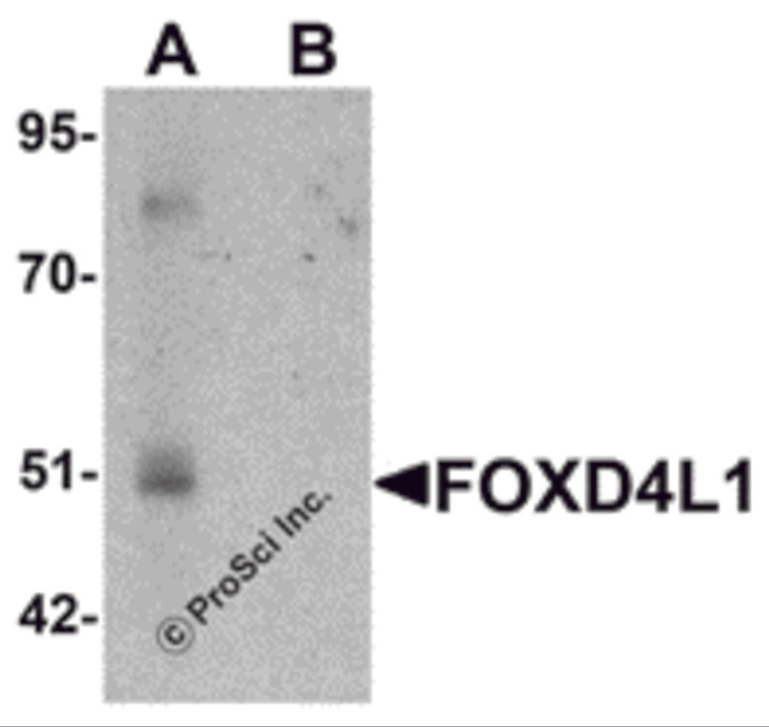Western blot analysis of FOXD4L1 in A-20 cell lysate with FOXD4L1 antibody at 1 μg/mL in (A) the absence and (B) the presence of blocking peptide.