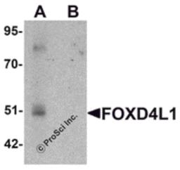 Western blot analysis of FOXD4L1 in A-20 cell lysate with FOXD4L1 antibody at 1 μg/mL in (A) the absence and (B) the presence of blocking peptide.