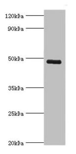 Western blot. All lanes: KCNN4 antibody at 8µg/ml + human serum. Secondary. Goat polyclonal to rabbit IgG at 1/10000 dilution. Predicted band size: 48 kDa. Observed band size: 48 kDa