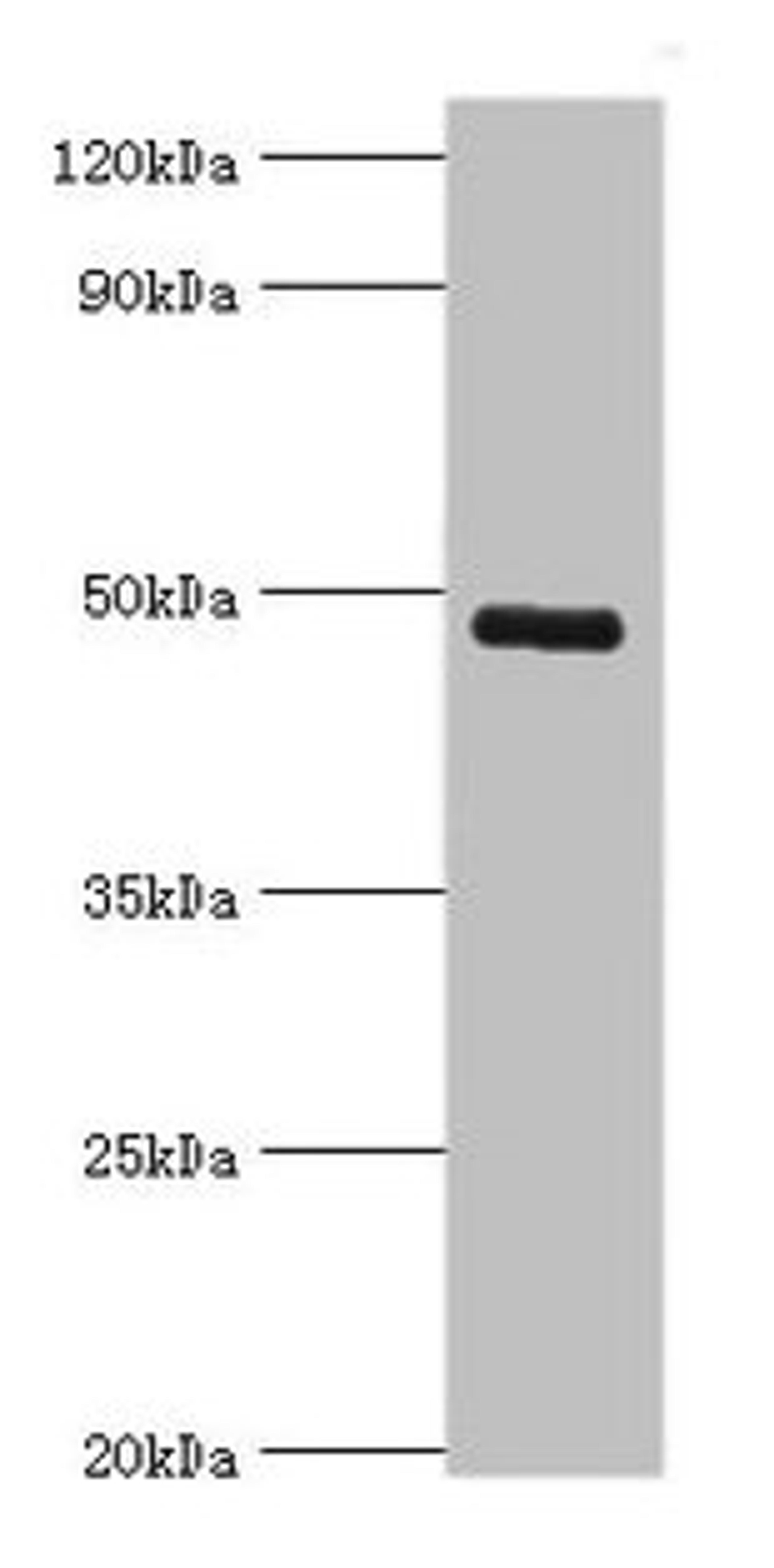 Western blot. All lanes: KCNN4 antibody at 8µg/ml + human serum. Secondary. Goat polyclonal to rabbit IgG at 1/10000 dilution. Predicted band size: 48 kDa. Observed band size: 48 kDa