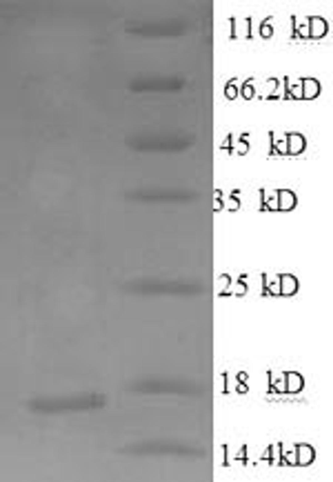 (Tris-Glycine gel) Discontinuous SDS-PAGE (reduced) with 5% enrichment gel and 15% separation gel.