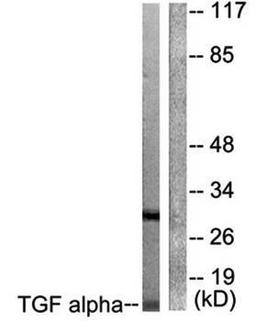 Western blot analysis of extracts from COS7 cells using TGF alpha antibody