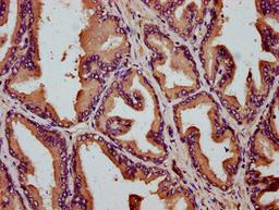 IHC image of CSB-PA741974LA01HU diluted at 1:200 and staining in paraffin-embedded human prostate tissue performed on a Leica BondTM system. After dewaxing and hydration, antigen retrieval was mediated by high pressure in a citrate buffer (pH 6.0). Section was blocked with 10% normal goat serum 30min at RT. Then primary antibody (1% BSA) was incubated at 4°C overnight. The primary is detected by a biotinylated secondary antibody and visualized using an HRP conjugated SP system.