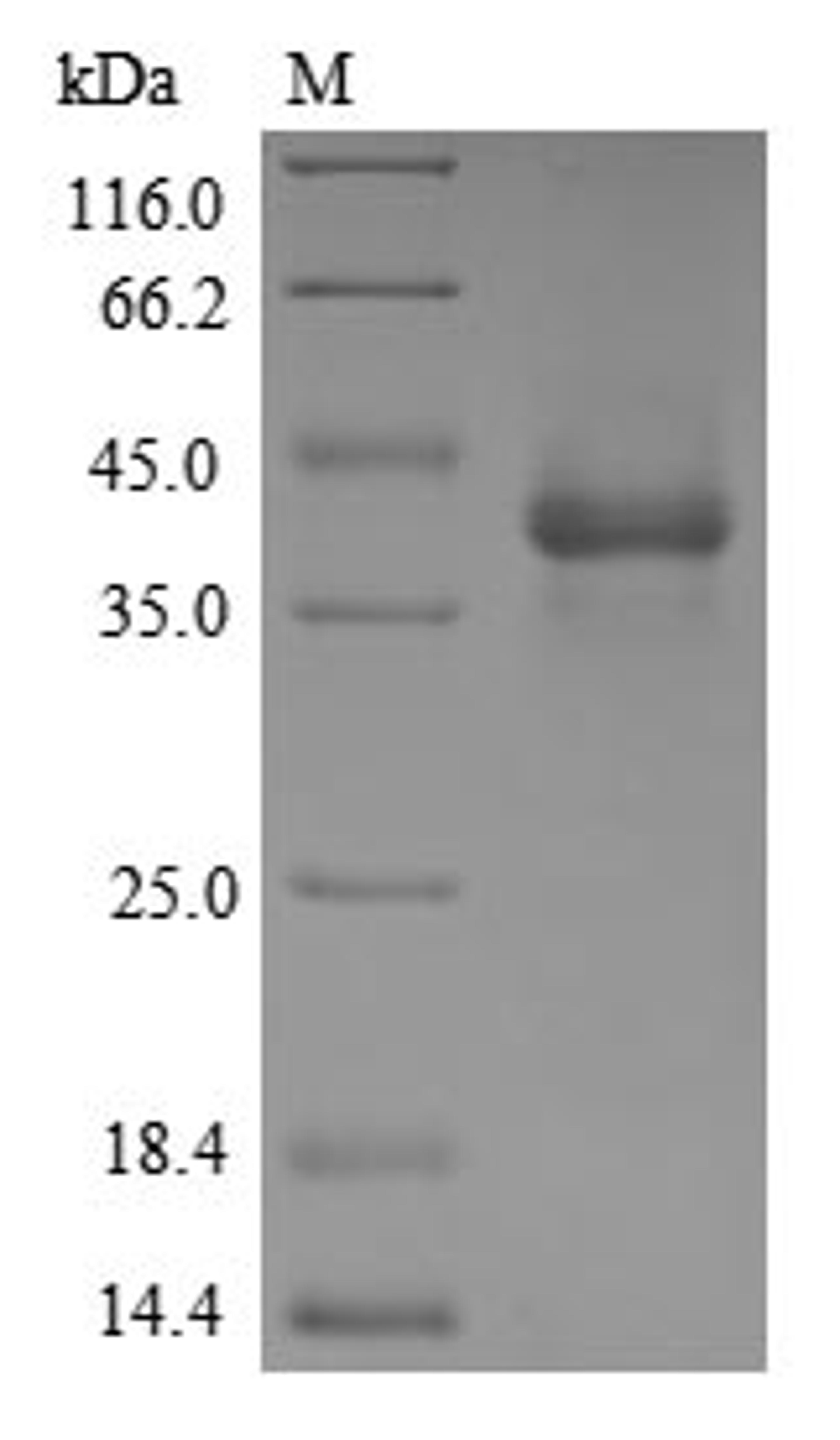 (Tris-Glycine gel) Discontinuous SDS-PAGE (reduced) with 5% enrichment gel and 15% separation gel.