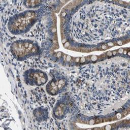 Immunohistochemistry-Paraffin: ERGI3 Antibody [NBP1-89881] - Staining of human small intestine shows cytoplasmic positivity in glandular cells.