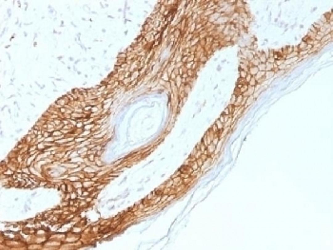 IHC testing of FFPE human skin with E-Cadherin antibody (clone 4A2). Required HIER: boil tissue sections in 10mM citrate buffer, pH 6.0, for 10-20 min.