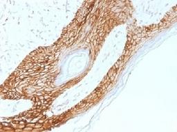 IHC testing of FFPE human skin with E-Cadherin antibody (clone 4A2). Required HIER: boil tissue sections in 10mM citrate buffer, pH 6.0, for 10-20 min.