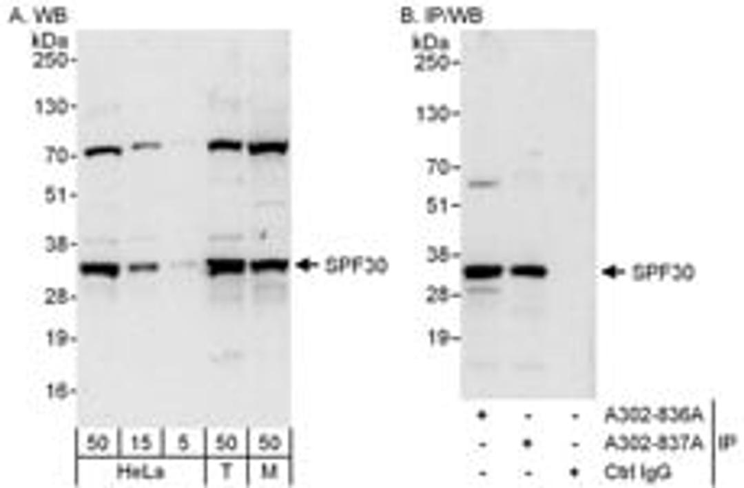 Detection of human and mouse SPF30 by western blot (h&m) and immunoprecipitation (h).