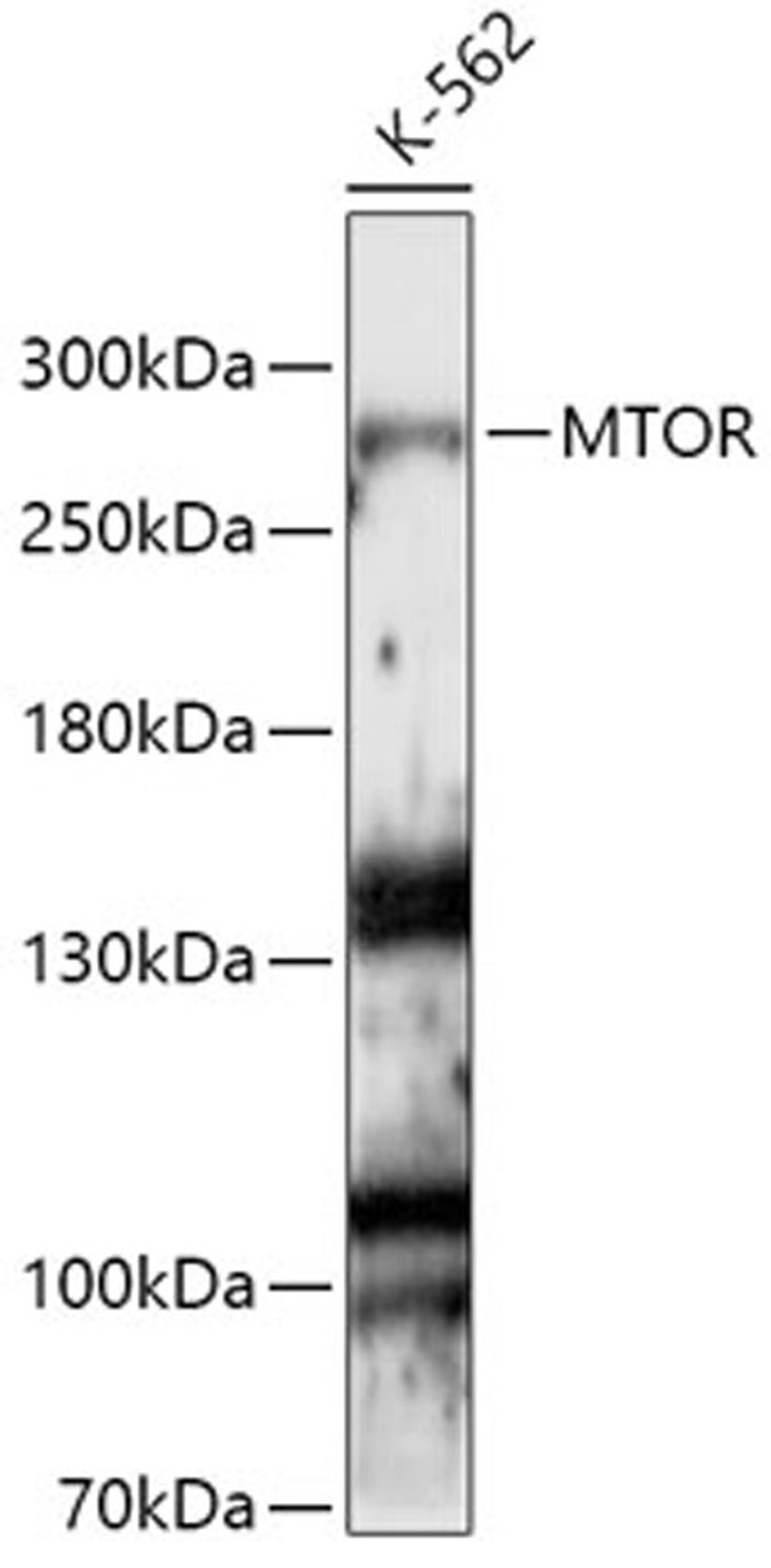 Western blot - mTOR antibody (A11345)