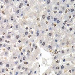 Immunohistochemical staining of rat liver tissue using GTF2F1 antibody (dilution of 1:200)