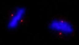 Detection of human ALMS1 by immunocytochemistry.