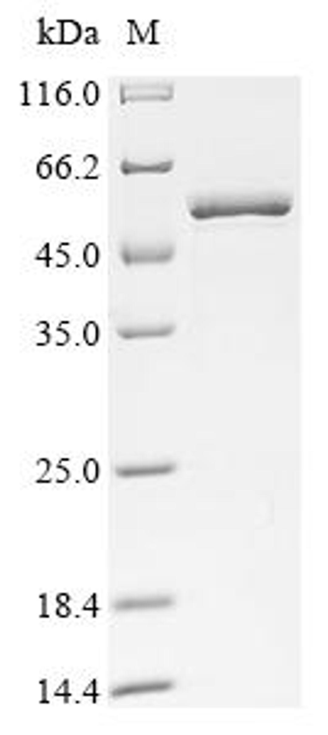 (Tris-Glycine gel) Discontinuous SDS-PAGE (reduced) with 5% enrichment gel and 15% separation gel.