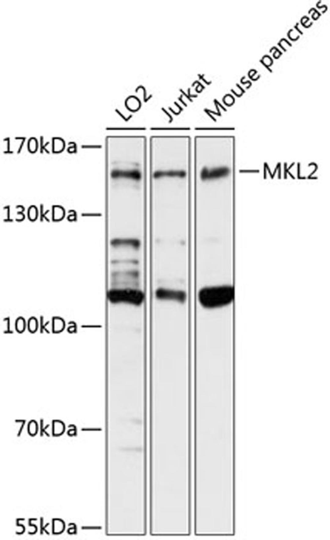 Western blot - MKL2 antibody (A13113)