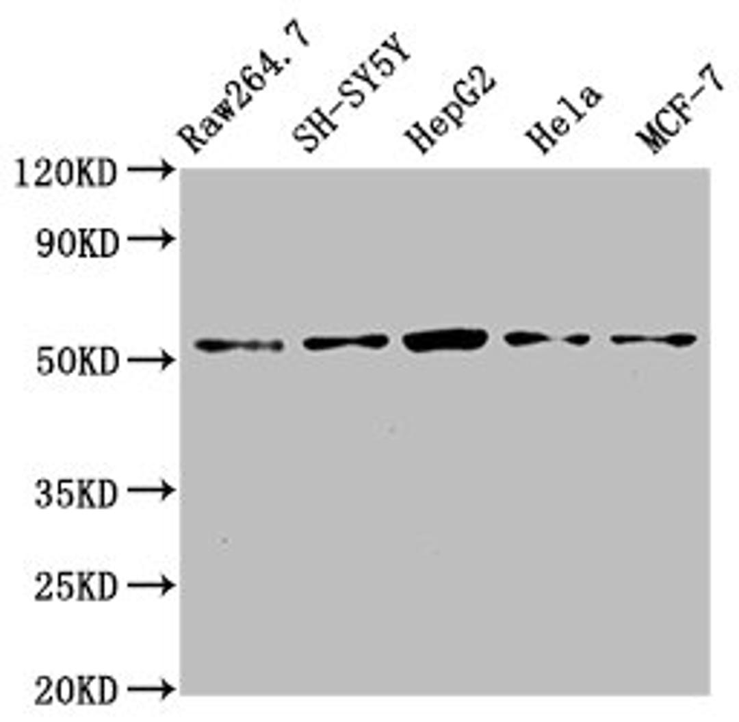 Western Blot. Positive WB detected in: RAW264.7 whole cell lysate, SH-SY5Y whole cell lysate, HepG2 whole cell lysate, Hela whole cell lysate, MCF-7 whole cell lysate. All lanes: MATN3 antibody at 4ug/ml. Secondary. Goat polyclonal to rabbit IgG at 1/50000 dilution. Predicted band size: 53, 49 kDa. Observed band size: 53 kDa. 