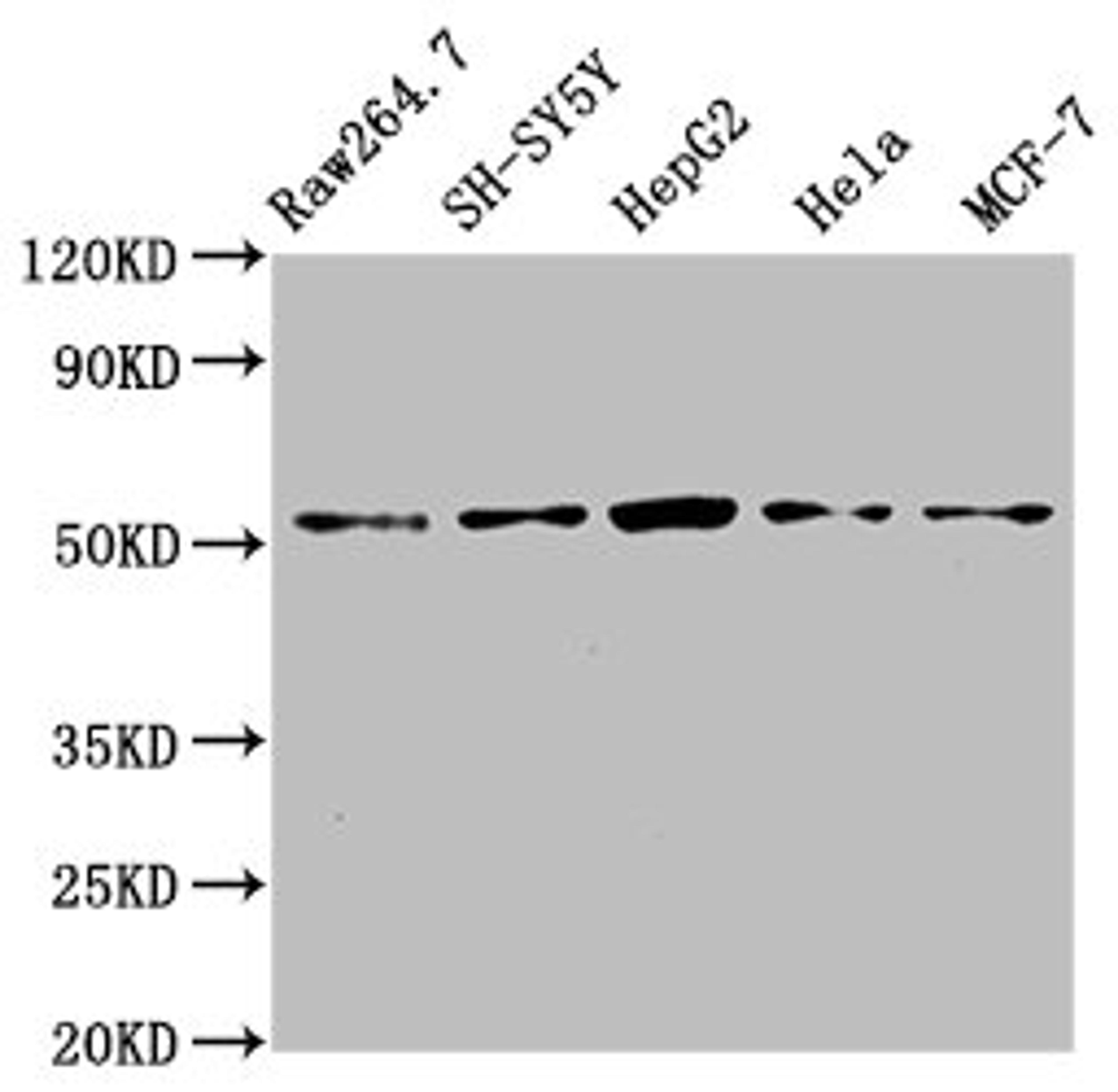 Western Blot. Positive WB detected in: RAW264.7 whole cell lysate, SH-SY5Y whole cell lysate, HepG2 whole cell lysate, Hela whole cell lysate, MCF-7 whole cell lysate. All lanes: MATN3 antibody at 4ug/ml. Secondary. Goat polyclonal to rabbit IgG at 1/50000 dilution. Predicted band size: 53, 49 kDa. Observed band size: 53 kDa. 