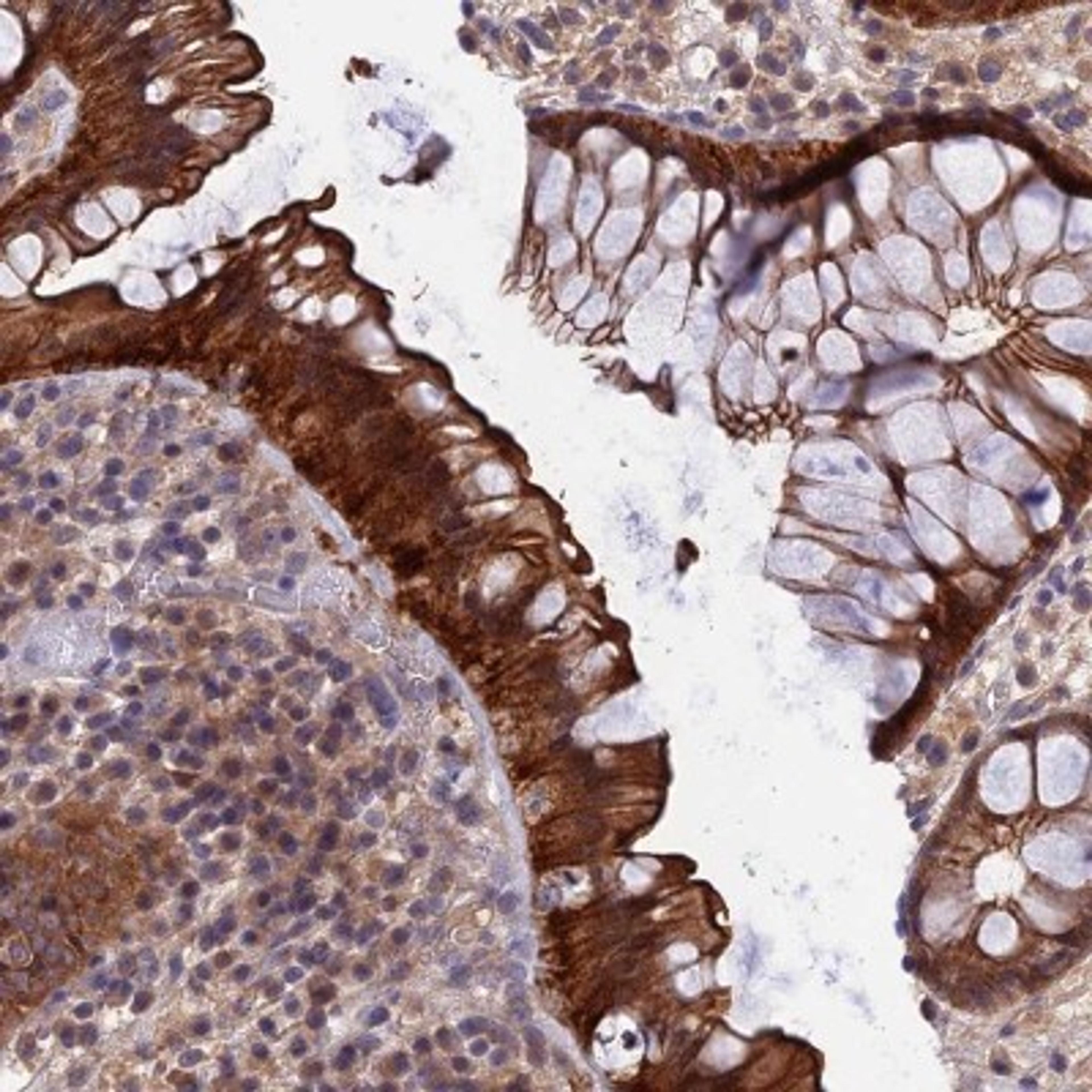 Immunohistochemistry: KIAA1211 Antibody [NBP2-30840] - Immunohistochemical staining of human rectum shows strong cytoplasmic and membranous positivity in glandular cells.