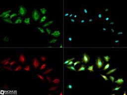 Immunocytochemistry/Immunofluorescence: ABCF2 Antibody [NB400-115] - ABCF2 antibody was tested in Hela cells with DyLight 488 (green). Nuclei and alpha-tubulin were counterstained with DAPI (blue) and Dylight 550 (red).