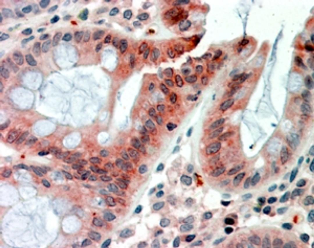 46-892 (2.5g/ml) staining of paraffin embedded Human Colon. Steamed antigen retrieval with citrate buffer pH 6, AP-staining.