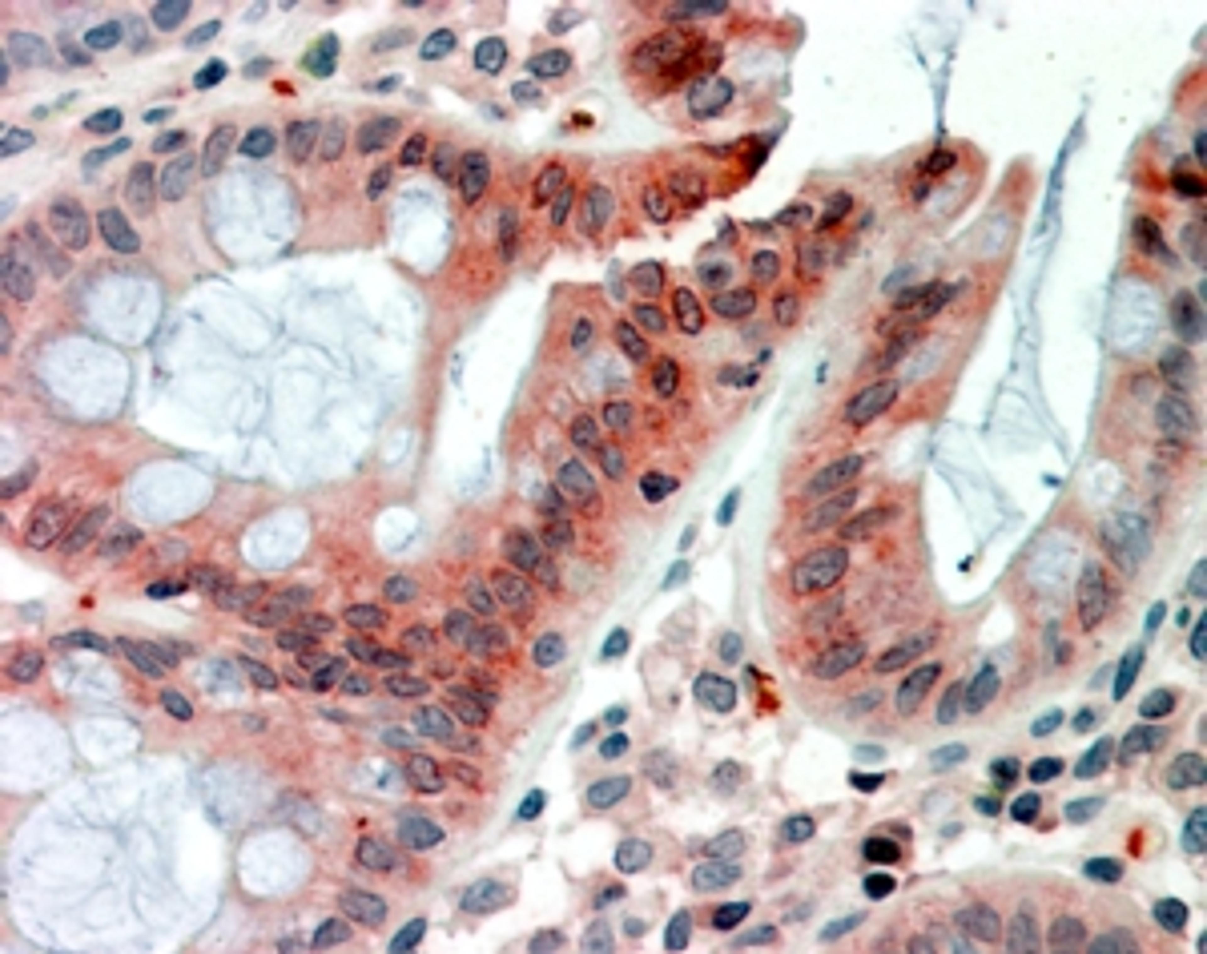 46-892 (2.5g/ml) staining of paraffin embedded Human Colon. Steamed antigen retrieval with citrate buffer pH 6, AP-staining.