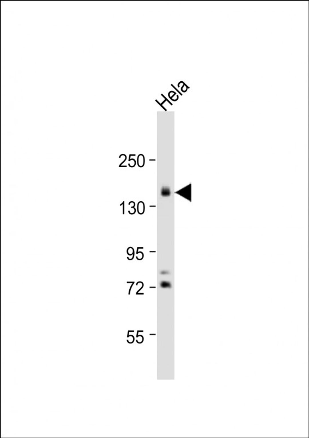 Western Blot at 1:1000 dilution + Hela whole cell lysate Lysates/proteins at 20 ug per lane.