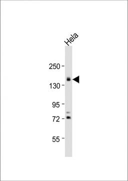 Western Blot at 1:1000 dilution + Hela whole cell lysate Lysates/proteins at 20 ug per lane.