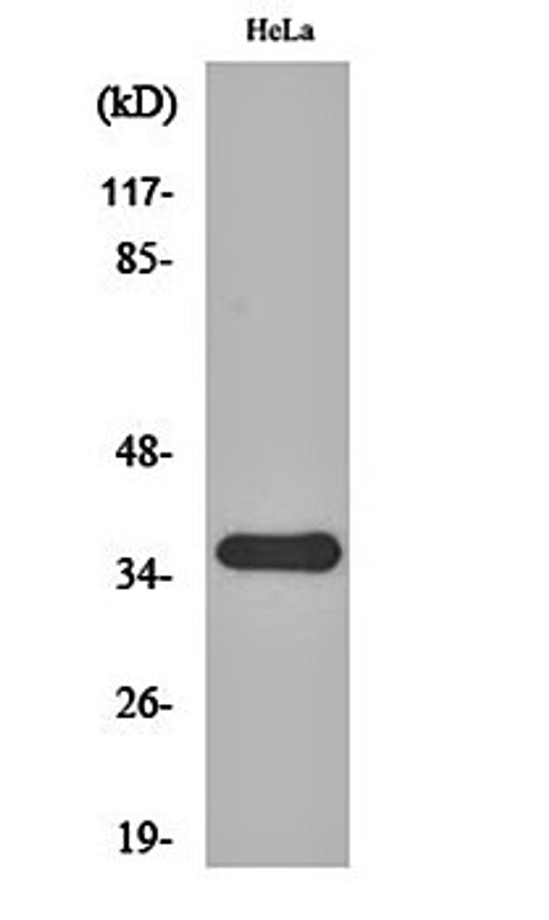 Western blot analysis of Hela cell lysates using FRP-2 antibody