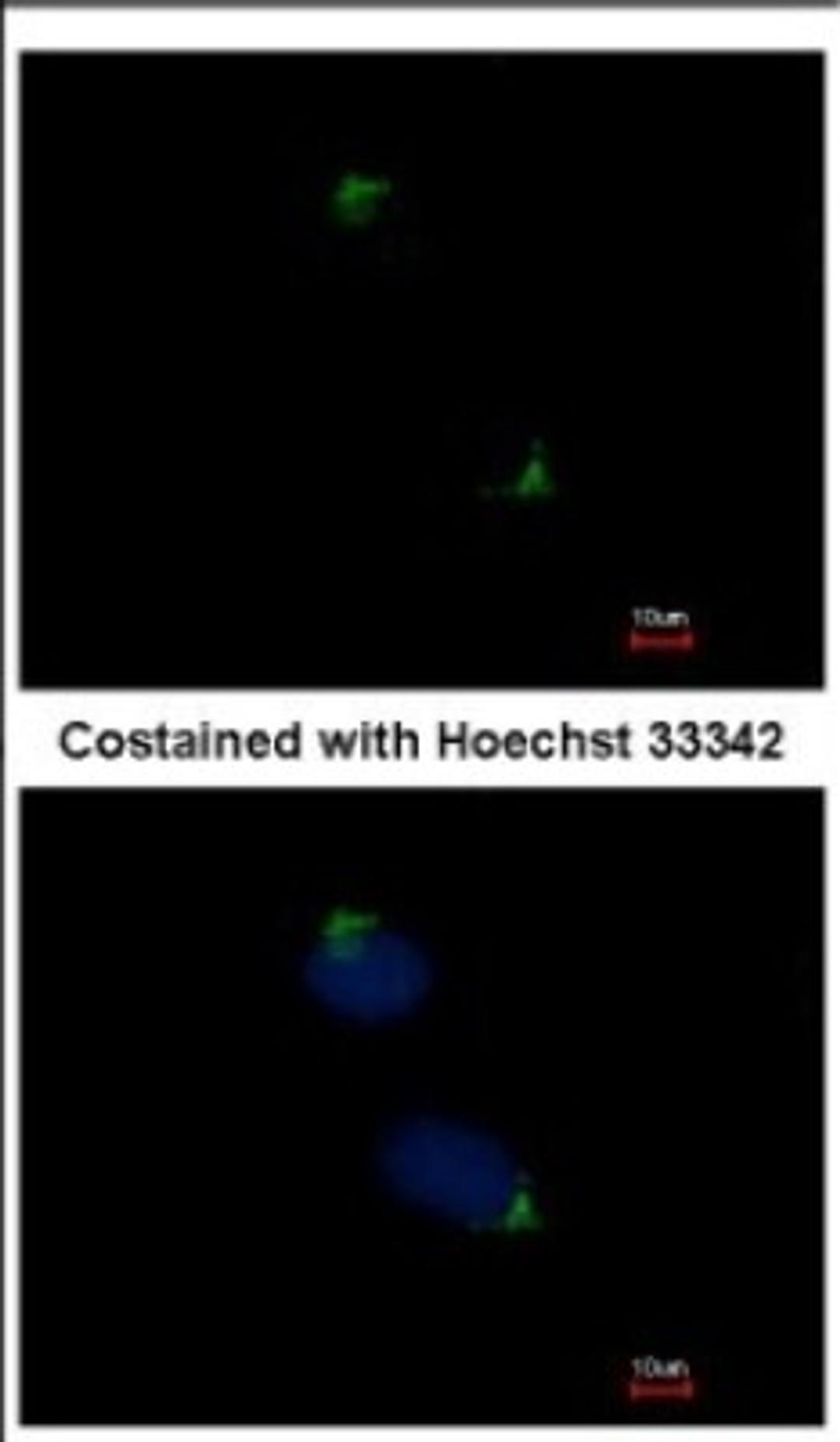 Immunocytochemistry/Immunofluorescence: Catenin alpha 1 Antibody [NBP2-15723] - Immunofluorescence analysis of methanol-fixed HeLa, using antibody at 1:500 dilution.