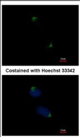 Immunocytochemistry/Immunofluorescence: Catenin alpha 1 Antibody [NBP2-15723] - Immunofluorescence analysis of methanol-fixed HeLa, using antibody at 1:500 dilution.