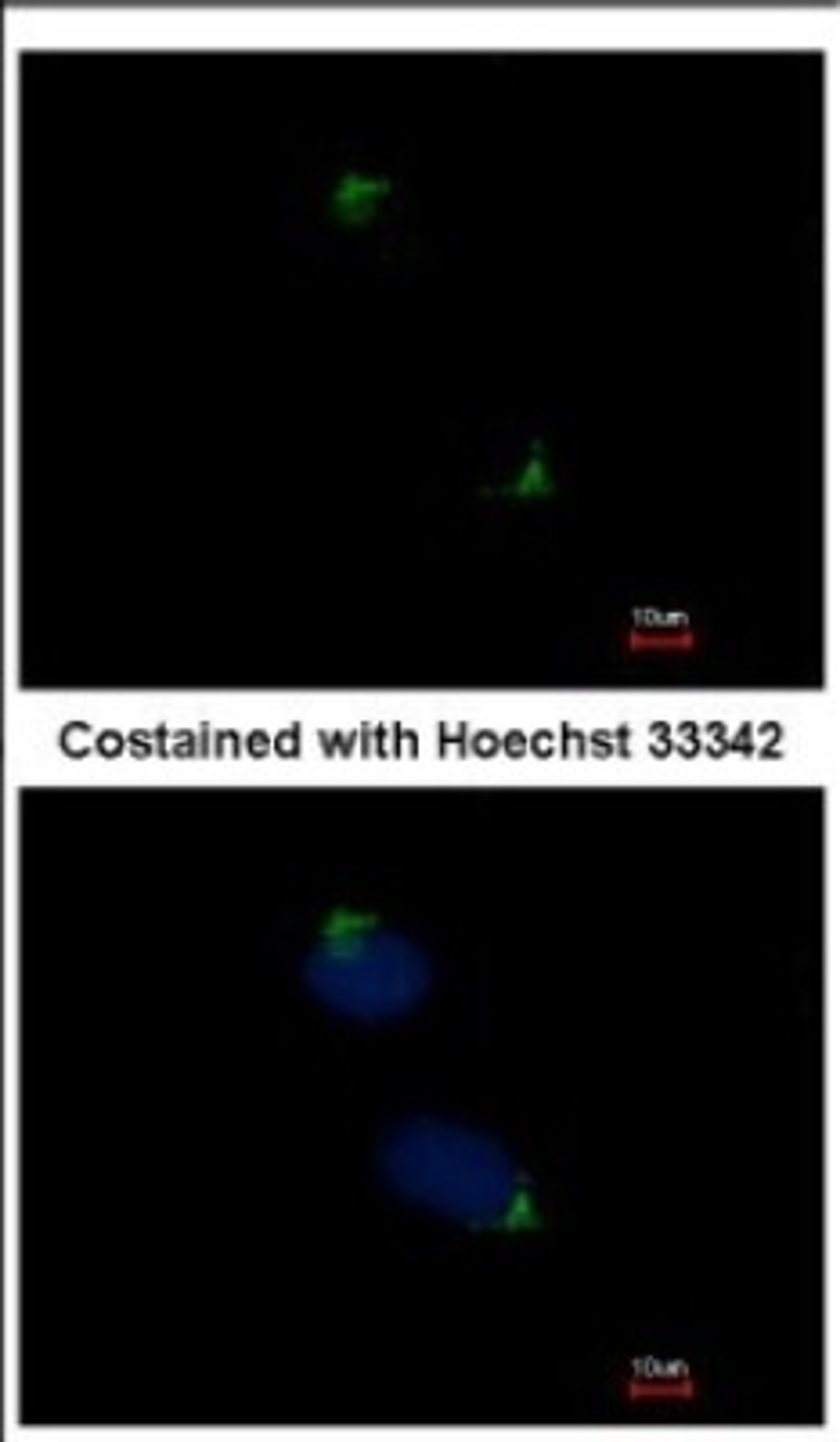 Immunocytochemistry/Immunofluorescence: Catenin alpha 1 Antibody [NBP2-15723] - Immunofluorescence analysis of methanol-fixed HeLa, using antibody at 1:500 dilution.