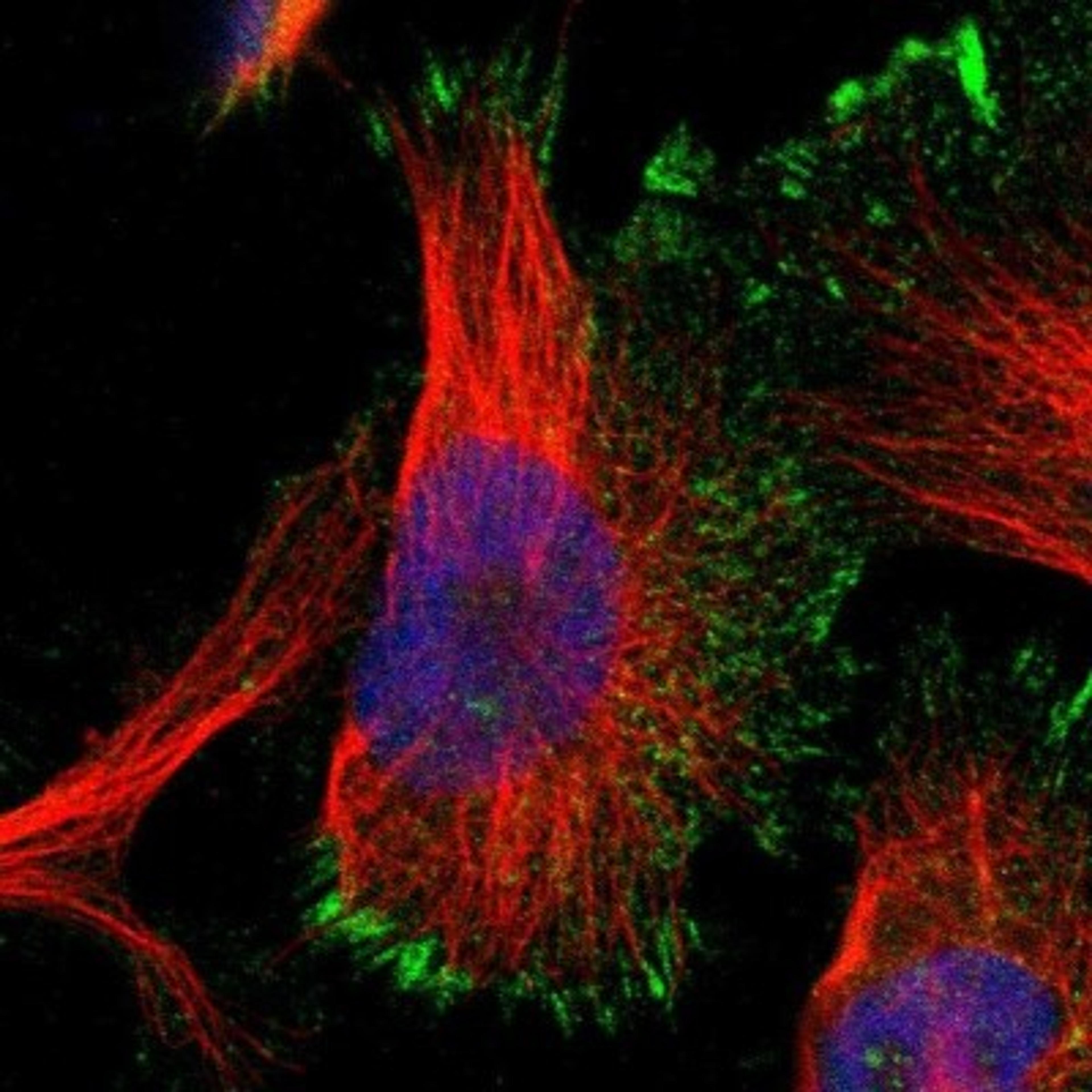 Immunocytochemistry/Immunofluorescence: Asialoglycoprotein Receptor 2 Antibody [NBP1-85578] - Immunofluorescent staining of human cell line U-251MG shows positivity in nucleoli, plasma membrane & focal adhesions.