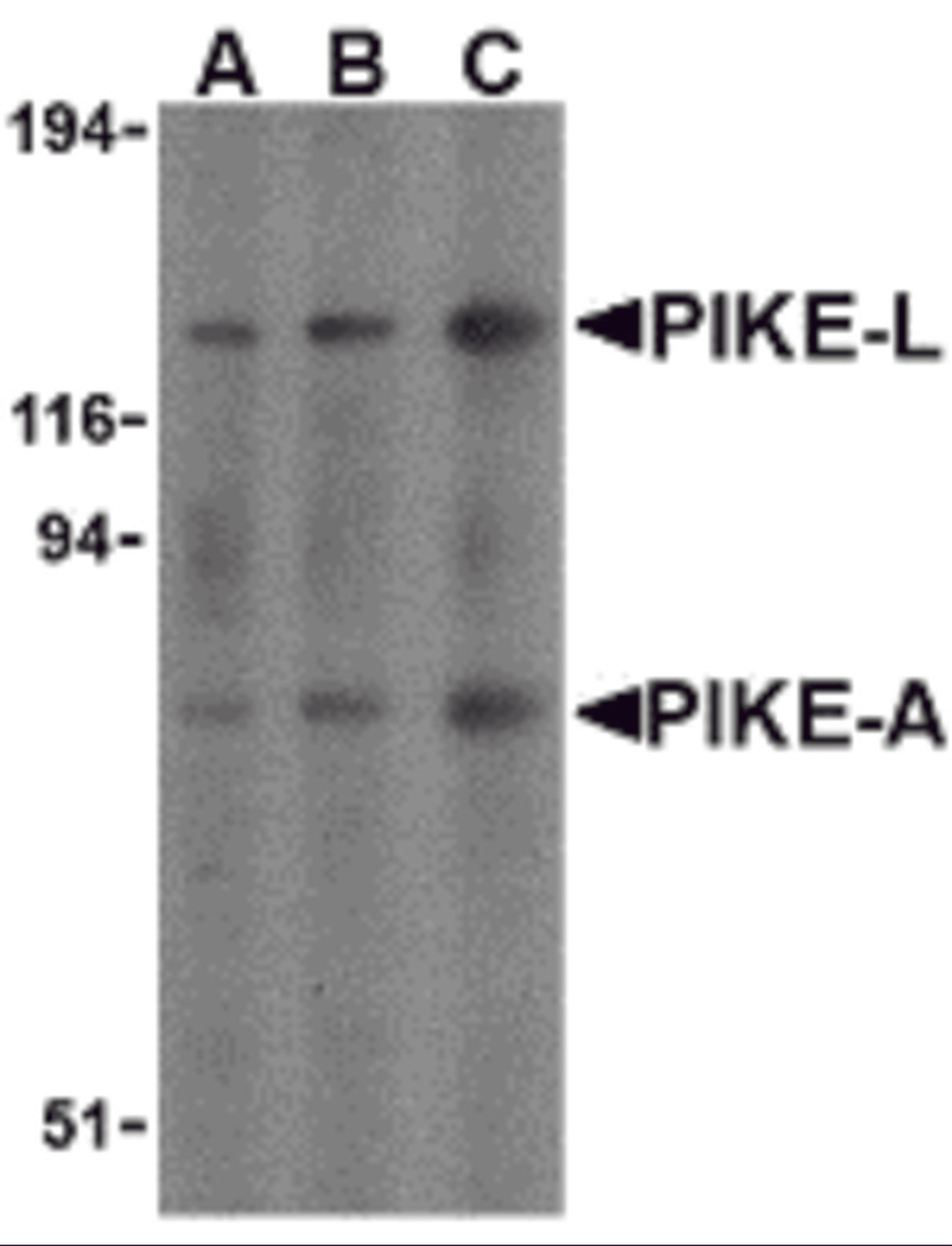 Western blot analysis of PIKE in mouse brain cell lysates with PIKE antibody at (A) 0.5, (B) 1, and (C) 2 &#956;g/mL. 