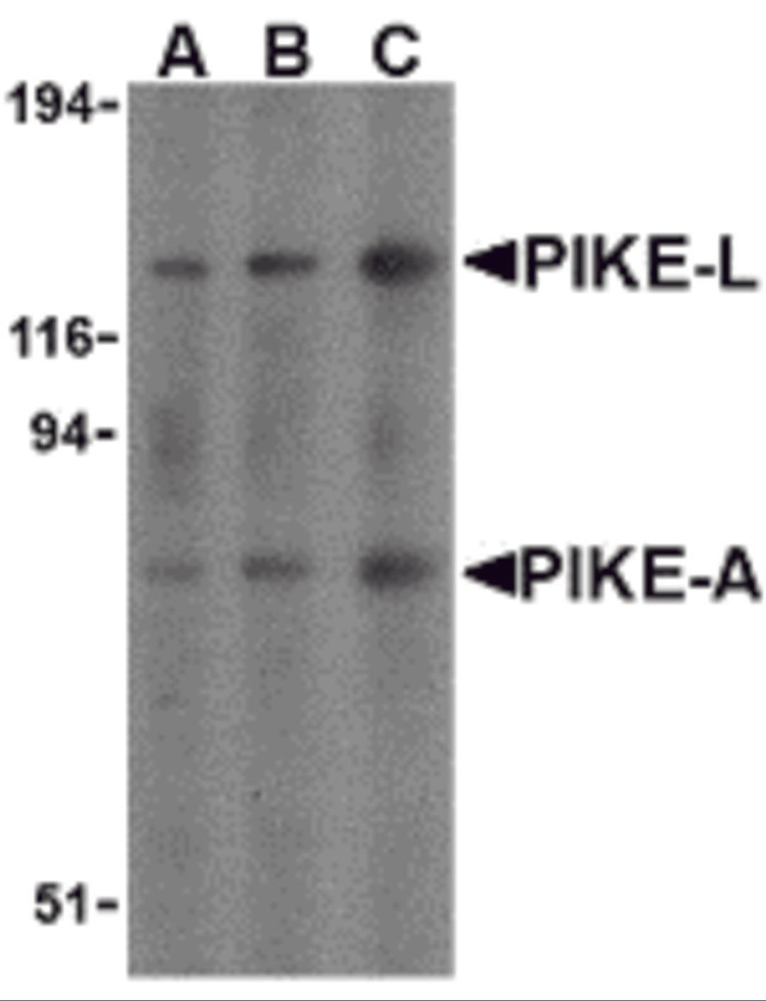 Western blot analysis of PIKE in mouse brain cell lysates with PIKE antibody at (A) 0.5, (B) 1, and (C) 2 μg/mL.