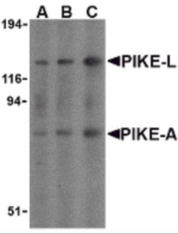 Western blot analysis of PIKE in mouse brain cell lysates with PIKE antibody at (A) 0.5, (B) 1, and (C) 2 μg/mL.