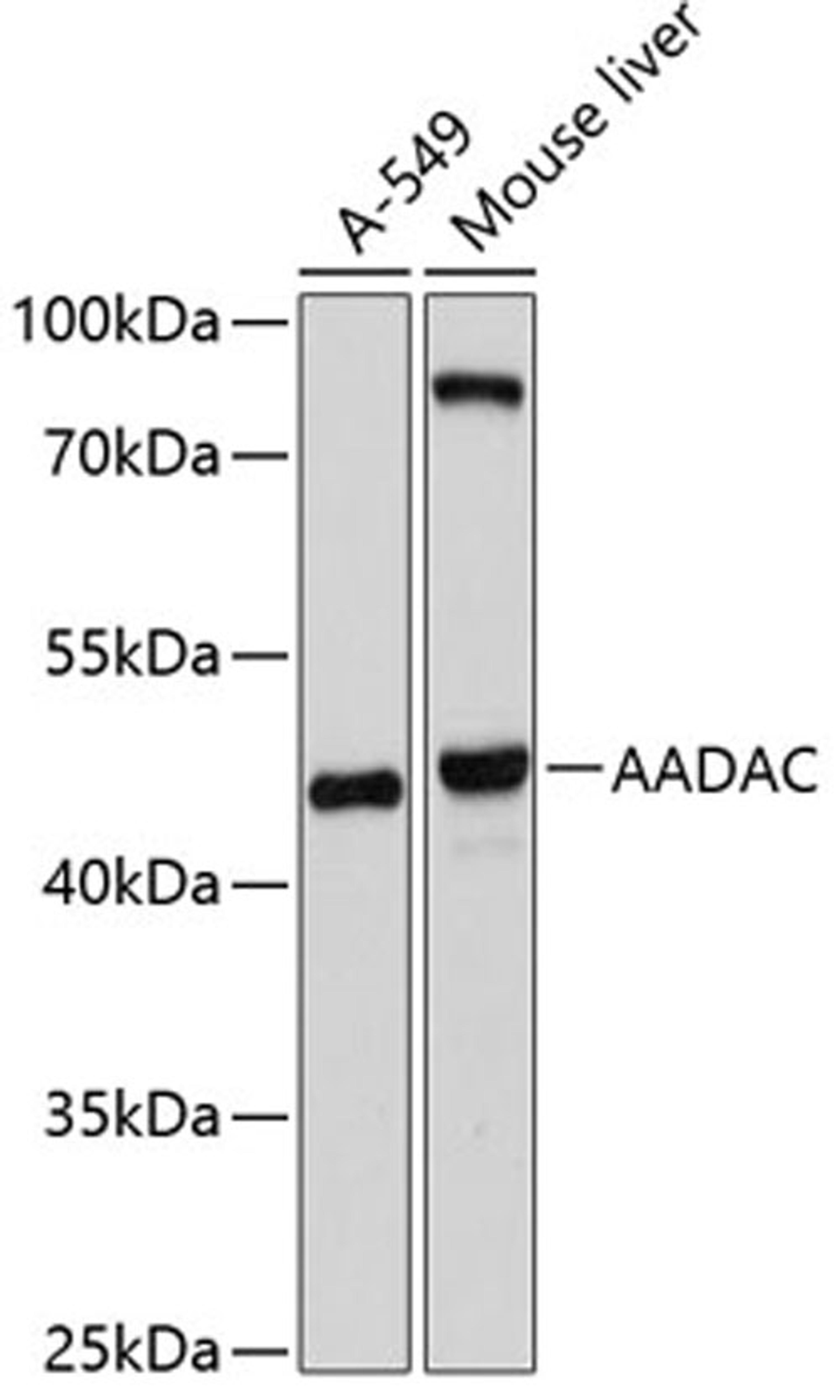 Western blot - AADAC antibody (A10365)