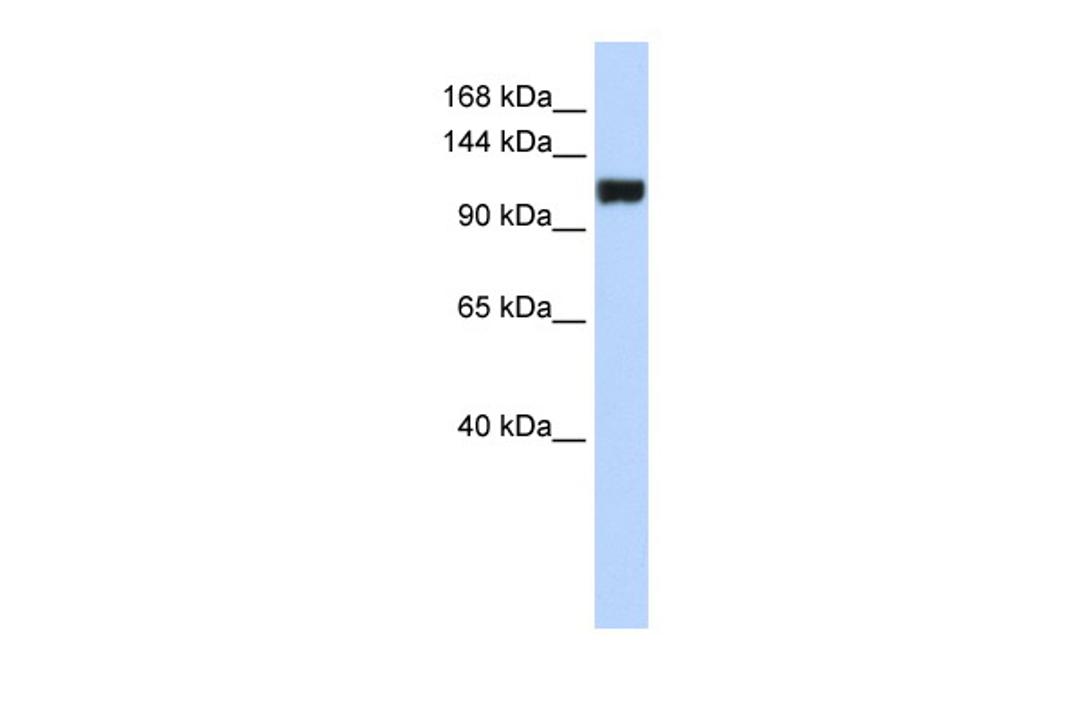 Antibody used in WB on Human MCF-7 at 0.2-1 ug/ml.