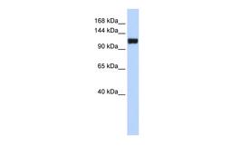 Antibody used in WB on Human MCF-7 at 0.2-1 ug/ml.