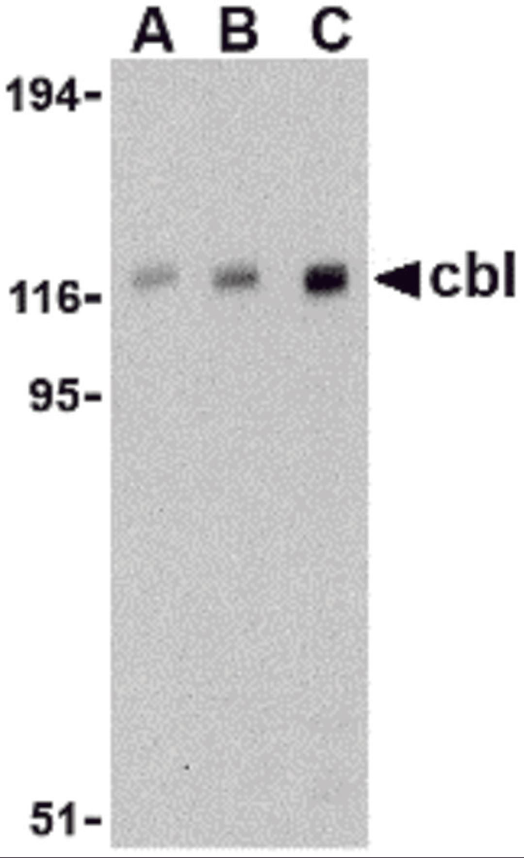 Western blot analysis of cbl in Daudi cell lysate with cbl antibody at (A) 0.5, (B) 1, and (C) 2 μg/mL.