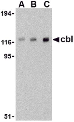 Western blot analysis of cbl in Daudi cell lysate with cbl antibody at (A) 0.5, (B) 1, and (C) 2 μg/mL.