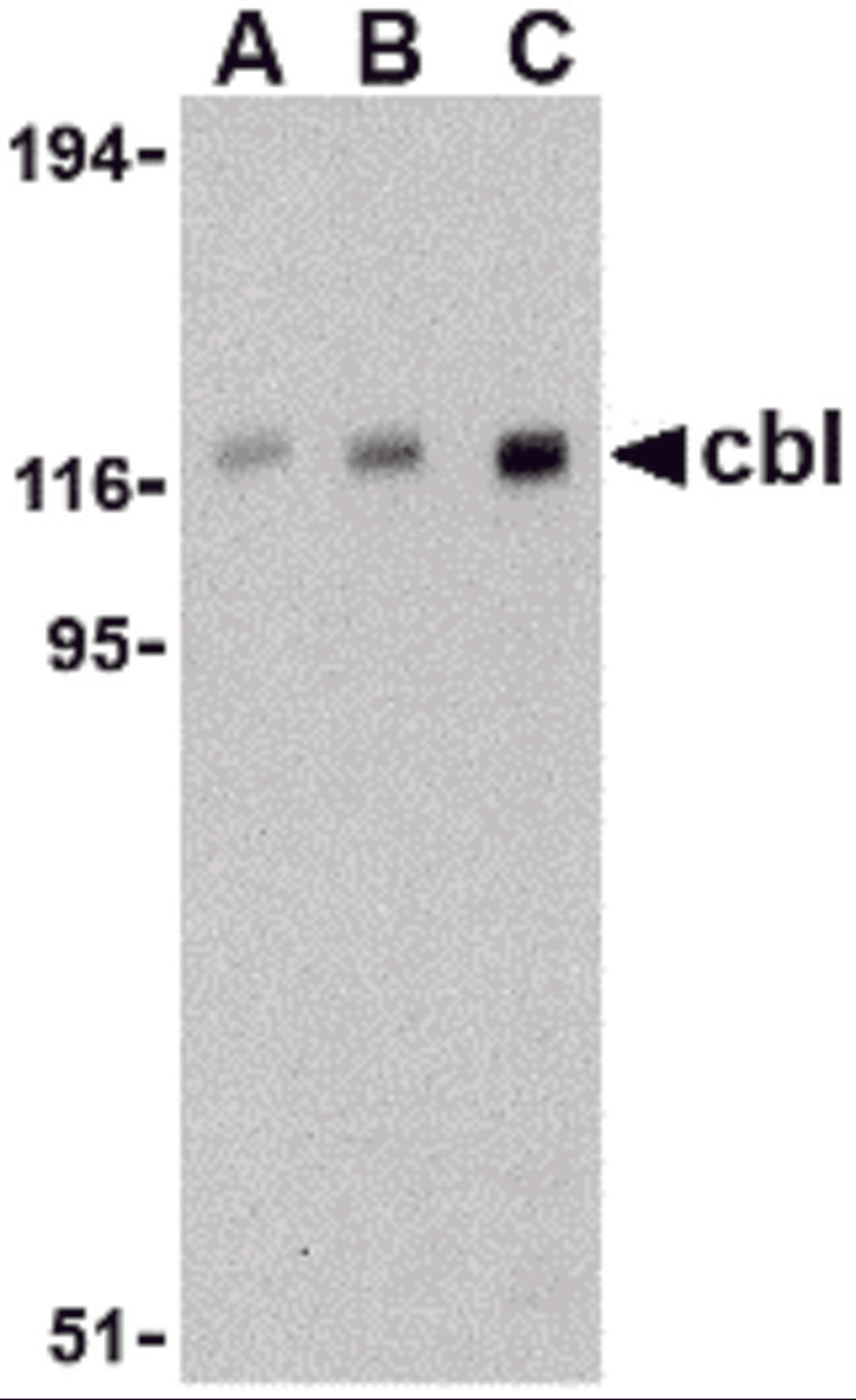 Western blot analysis of cbl in Daudi cell lysate with cbl antibody at (A) 0.5, (B) 1, and (C) 2 μg/mL.
