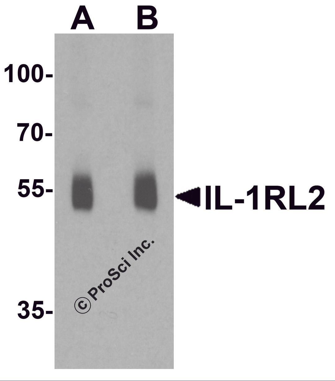 Western blot analysis of IL-1RL2 in human small intestine lysate with IL-1RL2 antibody at (A) 1 and (B) 2 μg/ml.