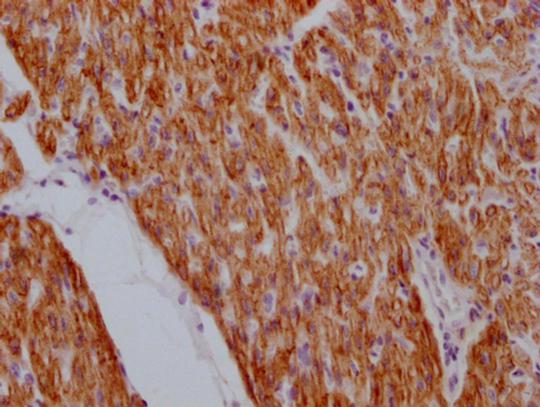 IHC image of CSB-MA923561 diluted at 1:100 and staining in paraffin-embedded human heart tissue performed on a Leica BondTM system. After dewaxing and hydration, antigen retrieval was mediated by high pressure in a citrate buffer (pH 6.0). Section was blocked with 10% normal goat serum 30min at RT. Then primary antibody (1% BSA) was incubated at 4°C overnight. The primary is detected by a Goat anti-mouse IgG polymer labeled by HRP and visualized using 0.05% DAB.