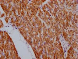 IHC image of CSB-MA923561 diluted at 1:100 and staining in paraffin-embedded human heart tissue performed on a Leica BondTM system. After dewaxing and hydration, antigen retrieval was mediated by high pressure in a citrate buffer (pH 6.0). Section was blocked with 10% normal goat serum 30min at RT. Then primary antibody (1% BSA) was incubated at 4°C overnight. The primary is detected by a Goat anti-mouse IgG polymer labeled by HRP and visualized using 0.05% DAB.