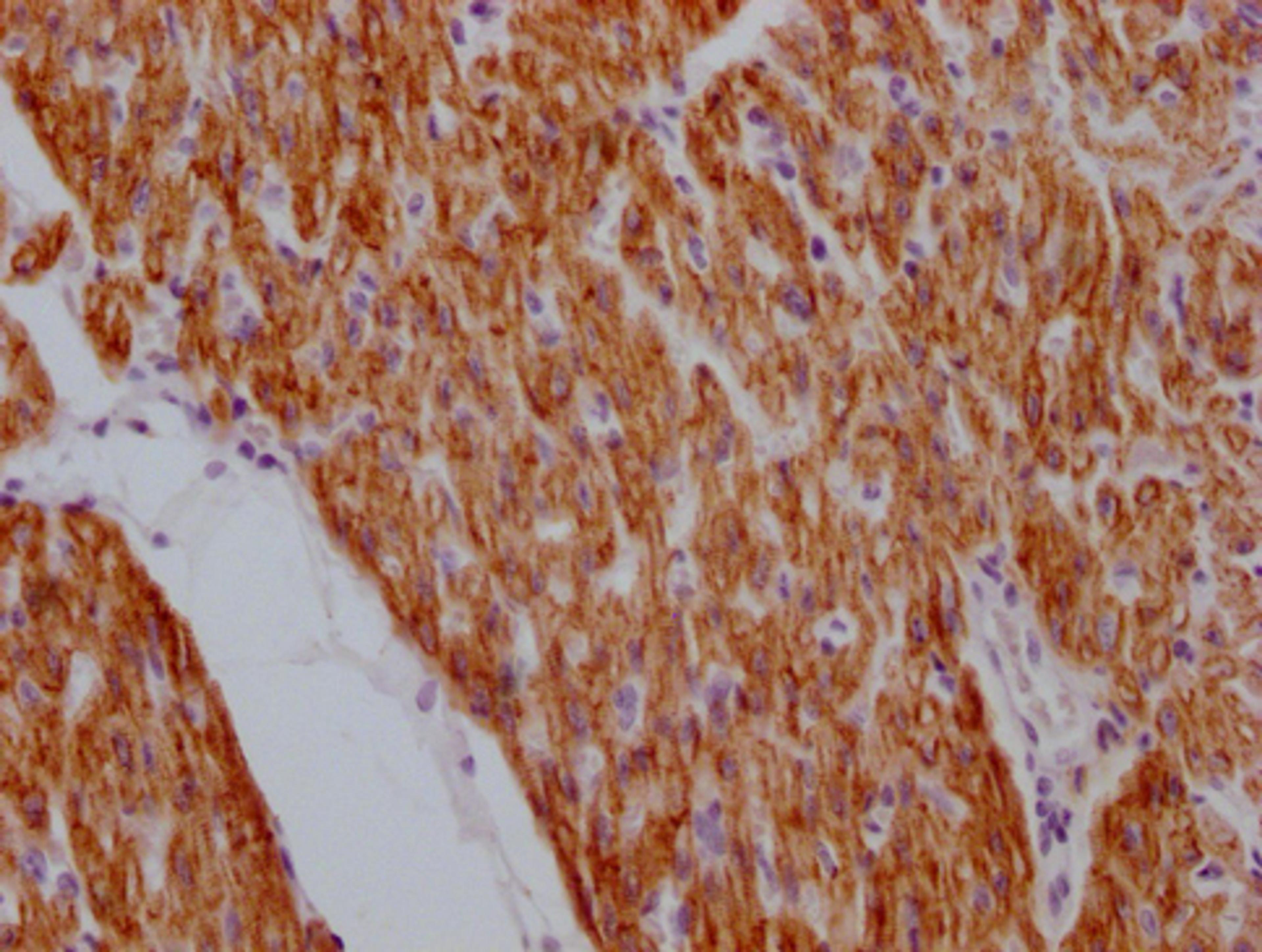 IHC image of CSB-MA923561 diluted at 1:100 and staining in paraffin-embedded human heart tissue performed on a Leica BondTM system. After dewaxing and hydration, antigen retrieval was mediated by high pressure in a citrate buffer (pH 6.0). Section was blocked with 10% normal goat serum 30min at RT. Then primary antibody (1% BSA) was incubated at 4°C overnight. The primary is detected by a Goat anti-mouse IgG polymer labeled by HRP and visualized using 0.05% DAB.