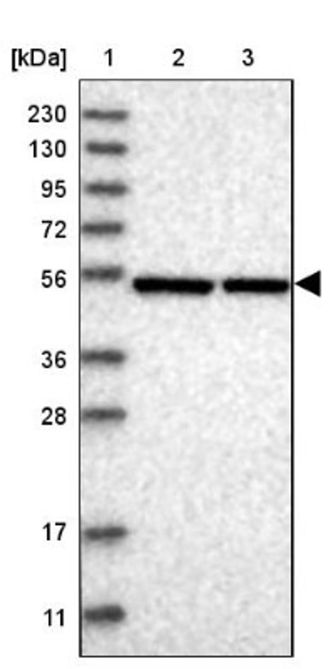 Western Blot: ERLEC1 Antibody [NBP1-86802] - Lane 1: Marker [kDa] 230, 130, 95, 72, 56, 36, 28, 17, 11<br/>Lane 2: Human cell line RT-4<br/>Lane 3: Human cell line U-251MG sp