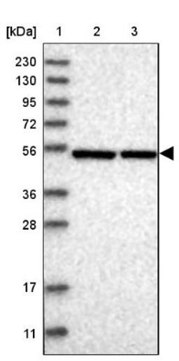 Western Blot: ERLEC1 Antibody [NBP1-86802] - Lane 1: Marker [kDa] 230, 130, 95, 72, 56, 36, 28, 17, 11<br/>Lane 2: Human cell line RT-4<br/>Lane 3: Human cell line U-251MG sp