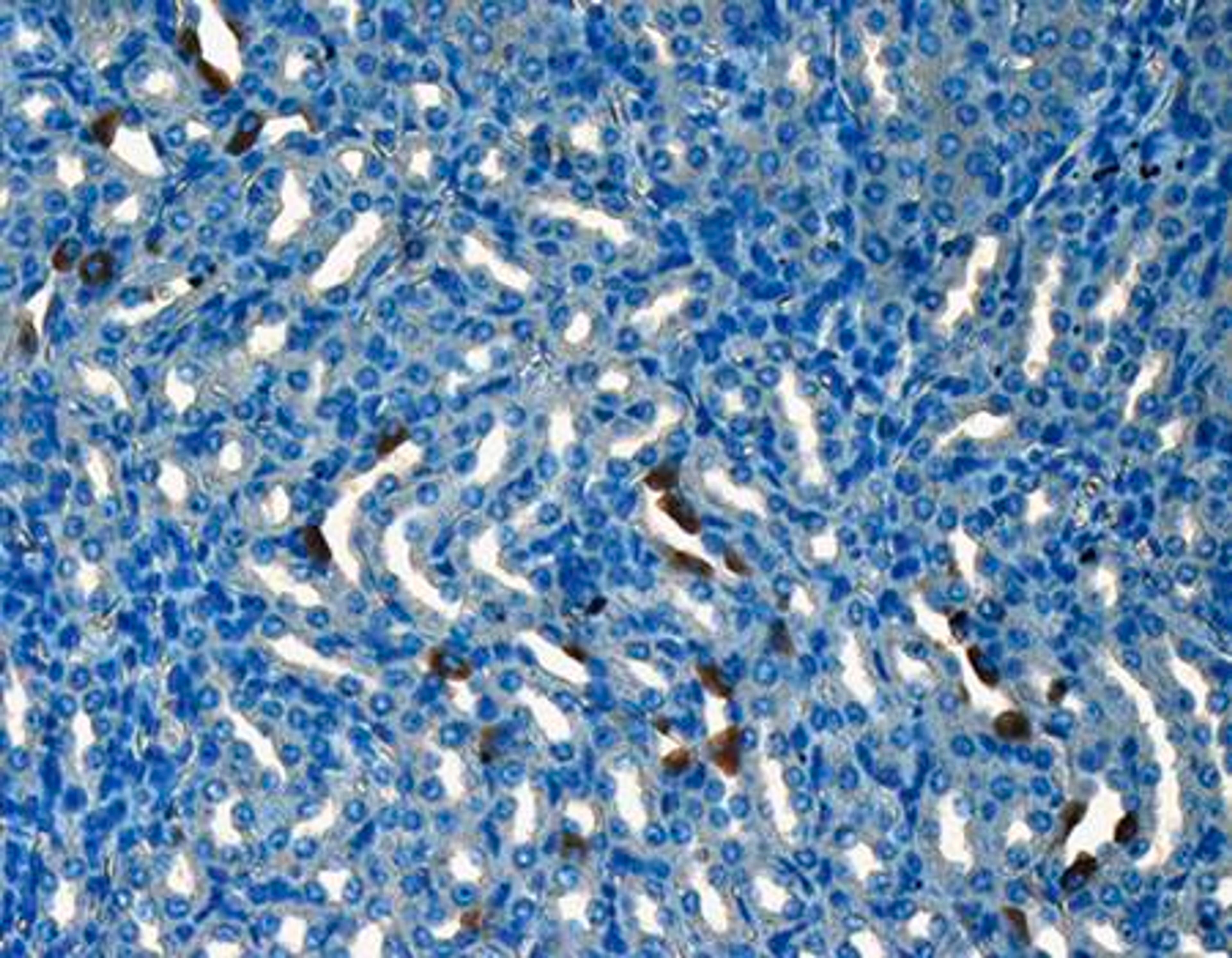 IHC-P analysis of mouse kidney tissue using CD133 antibody (Primary antibody diluted to 1:200) 