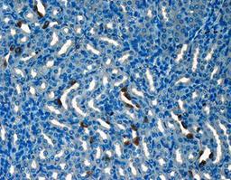 IHC-P analysis of mouse kidney tissue using CD133 antibody (Primary antibody diluted to 1:200)